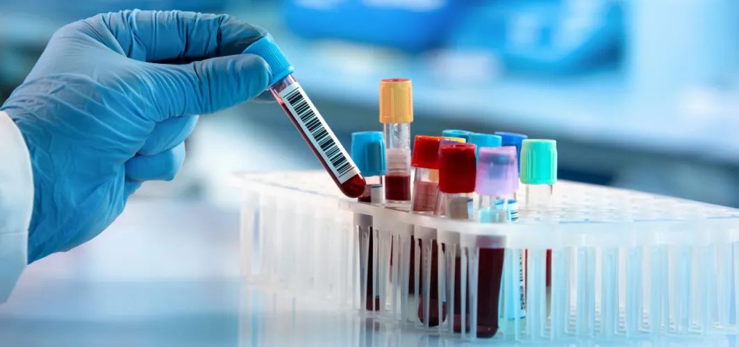 Diagnostics in Nalasopara